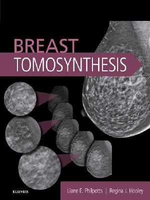 Breast Tomosynthesis E-Book (ePub eBook)